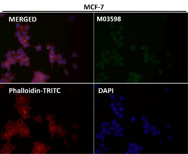 1 - Anti-ATP5A1/Atp5A Rabbit Monoclonal Antibody ABO13871