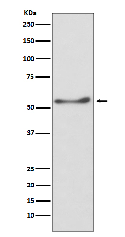 1 - Anti-ATP5A1/Atp5A Rabbit Monoclonal Antibody ABO13871