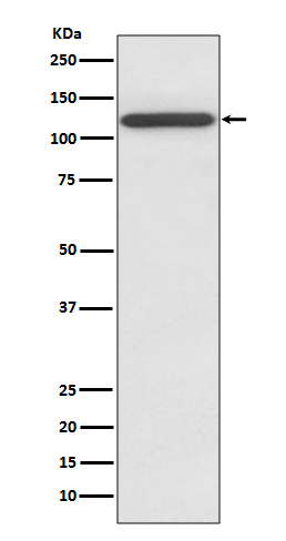 1 - Anti-NMDAR1 GRIN1 Rabbit Monoclonal Antibody ABO13873