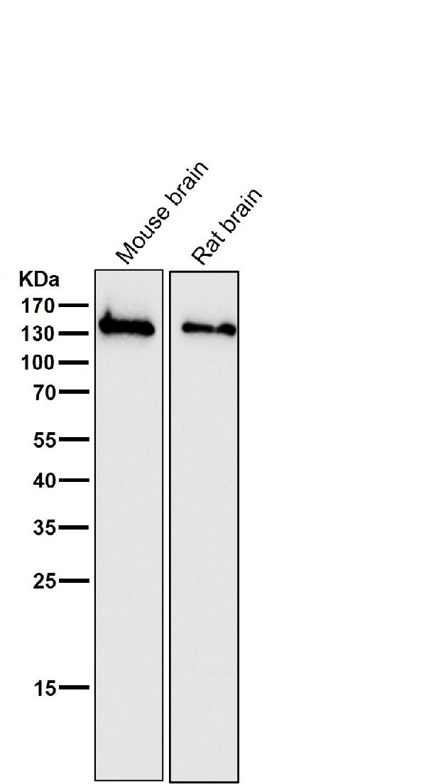 1 - Anti-NMDAR1 GRIN1 Rabbit Monoclonal Antibody ABO13873