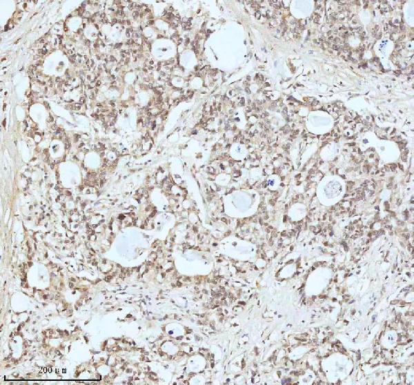 2 - Anti-Drosha Rabbit Monoclonal Antibody ABO13877