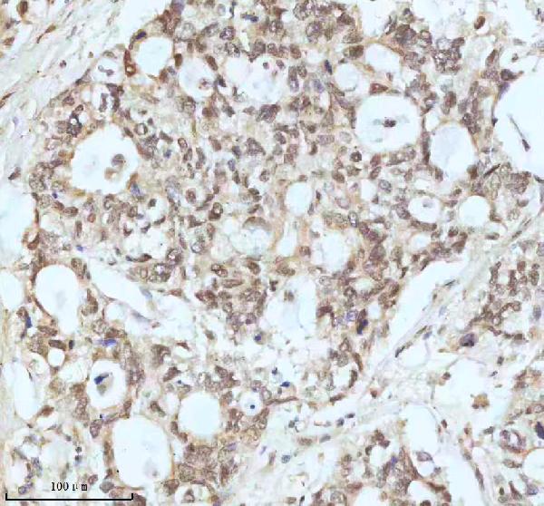 2 - Anti-Drosha Rabbit Monoclonal Antibody ABO13877