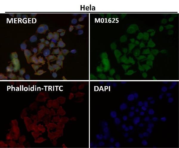 1 - Anti-SNAP25 Rabbit Monoclonal Antibody ABO13878