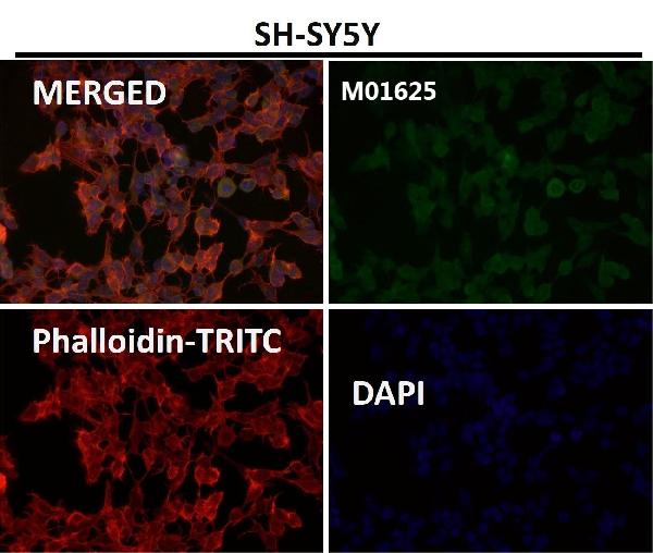 1 - Anti-SNAP25 Rabbit Monoclonal Antibody ABO13878