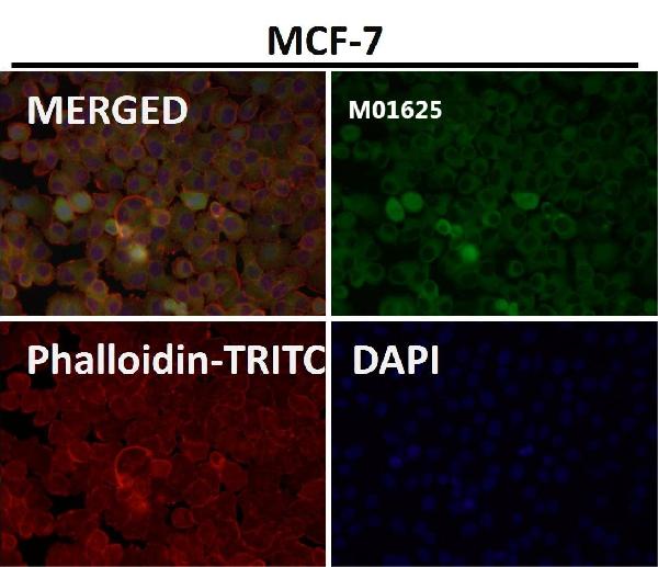 1 - Anti-SNAP25 Rabbit Monoclonal Antibody ABO13878