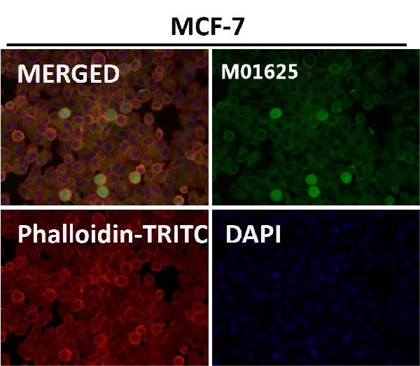 1 - Anti-SNAP25 Rabbit Monoclonal Antibody ABO13878