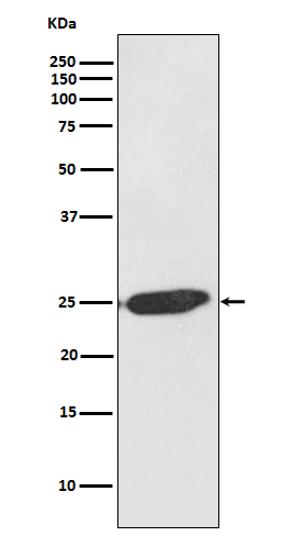 1 - Anti-SNAP25 Rabbit Monoclonal Antibody ABO13878