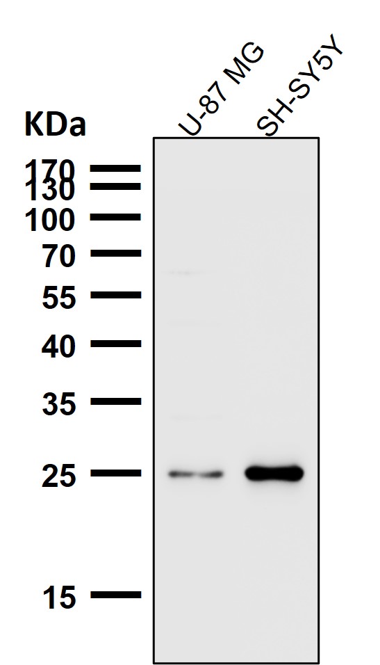 1 - Anti-SNAP25 Rabbit Monoclonal Antibody ABO13878