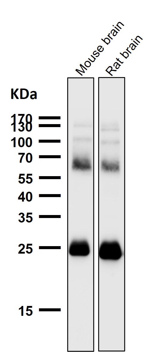 1 - Anti-SNAP25 Rabbit Monoclonal Antibody ABO13878
