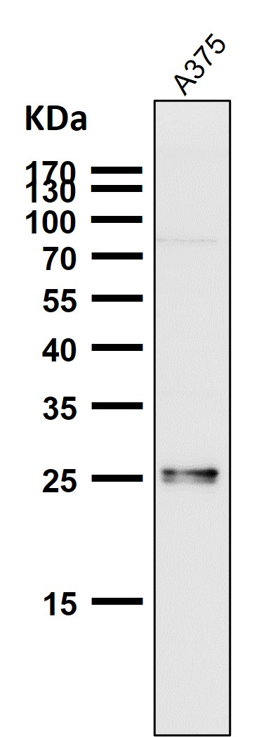 1 - Anti-SNAP25 Rabbit Monoclonal Antibody ABO13878