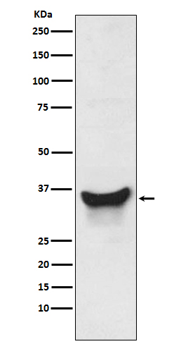 1 - Anti-BNIP3L/Nix Rabbit Monoclonal Antibody ABO13880