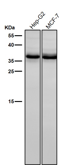 1 - Anti-BNIP3L/Nix Rabbit Monoclonal Antibody ABO13880