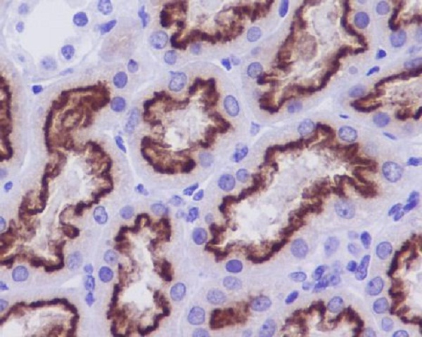 2 - Anti-Cubilin CUBN Rabbit Monoclonal Antibody ABO13882