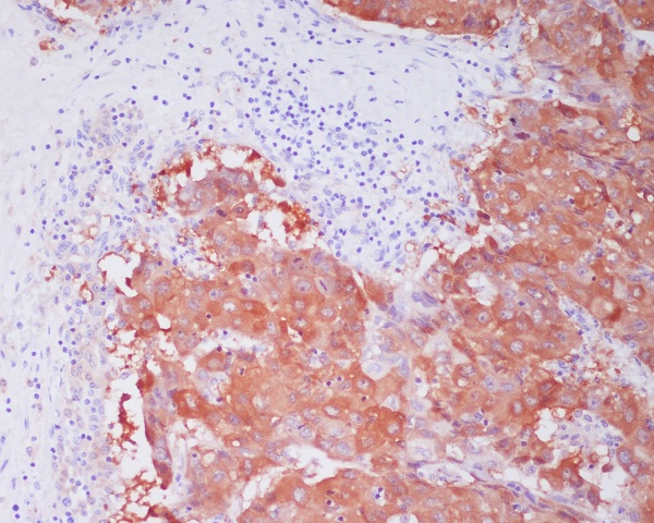 2 - Anti-ALDH1A1 Rabbit Monoclonal Antibody ABO13884