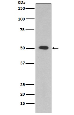 1 - Anti-ALDH1A1 Rabbit Monoclonal Antibody ABO13884