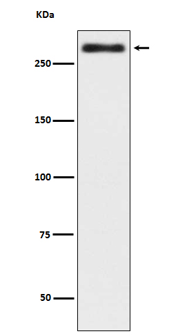 1 - Anti-Talin 2 TLN2 Rabbit Monoclonal Antibody ABO13885