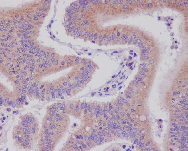 2 - Anti-DNAJC15 Rabbit Monoclonal Antibody ABO13887