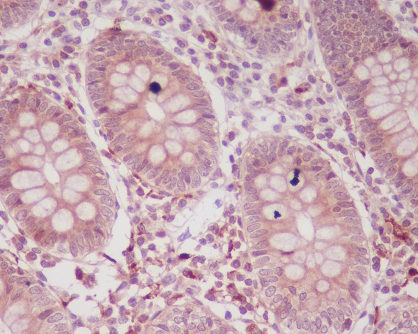 2 - Anti-p16 ARC ARPC5 Rabbit Monoclonal Antibody ABO13888