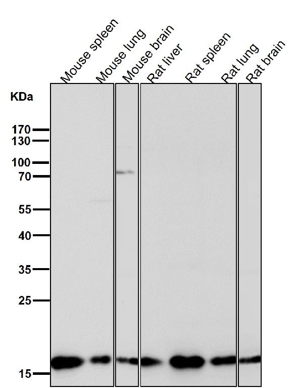 1 - Anti-p16 ARC ARPC5 Rabbit Monoclonal Antibody ABO13888