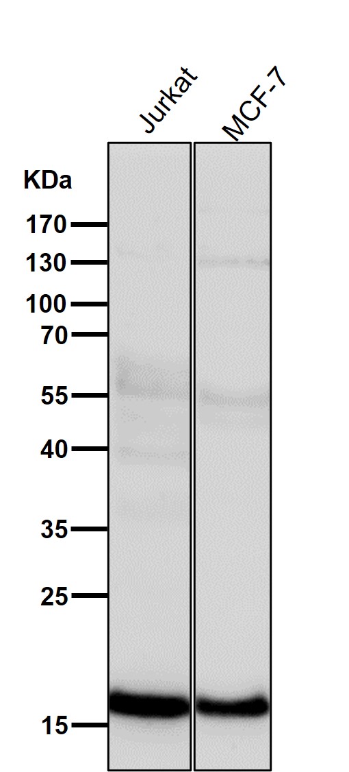 1 - Anti-p16 ARC ARPC5 Rabbit Monoclonal Antibody ABO13888