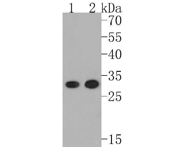 1 - Anti-DARPP32 PPP1R1B Rabbit Monoclonal Antibody ABO13889