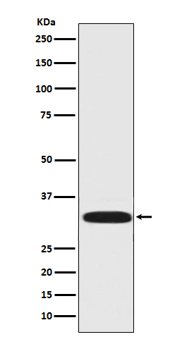1 - Anti-DARPP32 PPP1R1B Rabbit Monoclonal Antibody ABO13889
