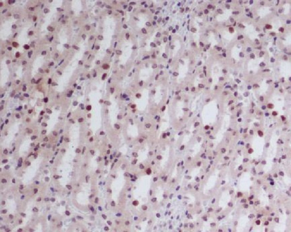 2 - Anti-GATA2/3 Rabbit Monoclonal Antibody ABO13891