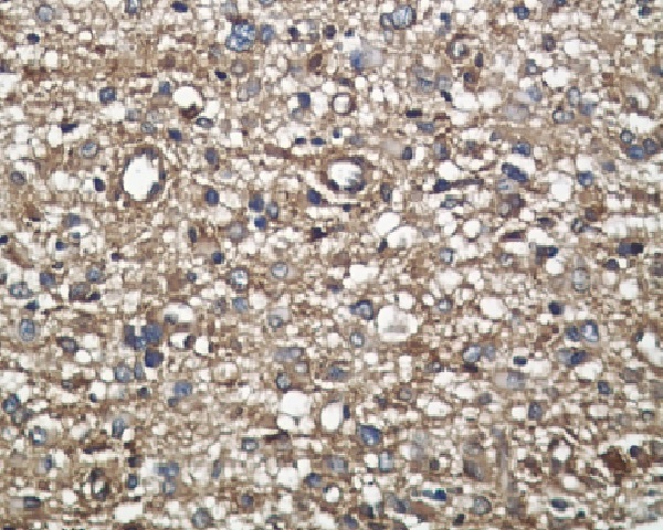 2 - Anti-Midkine MDK Rabbit Monoclonal Antibody ABO13892