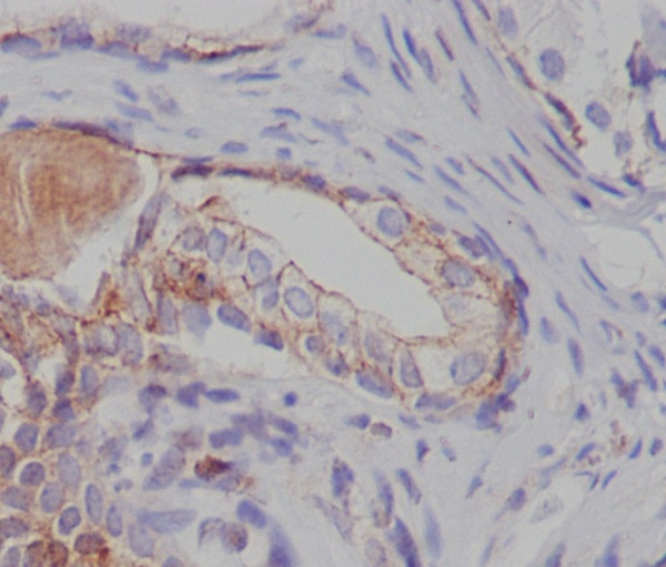 2 - Anti-Tuberin TSC2 Rabbit Monoclonal Antibody ABO13893