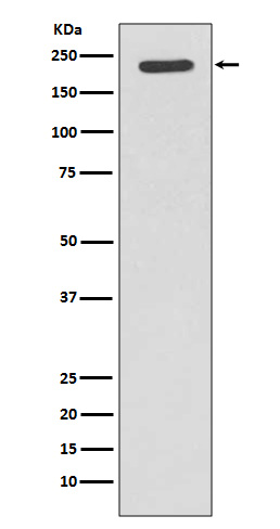 1 - Anti-Tuberin TSC2 Rabbit Monoclonal Antibody ABO13893