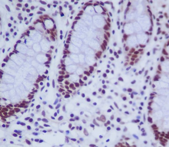 2 - Anti-hnRNP K Rabbit Monoclonal Antibody ABO13895