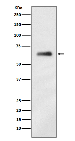 1 - Anti-hnRNP K Rabbit Monoclonal Antibody ABO13895