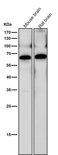 1 - Anti-hnRNP K Rabbit Monoclonal Antibody ABO13895