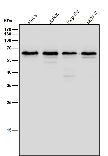 1 - Anti-hnRNP K Rabbit Monoclonal Antibody ABO13895