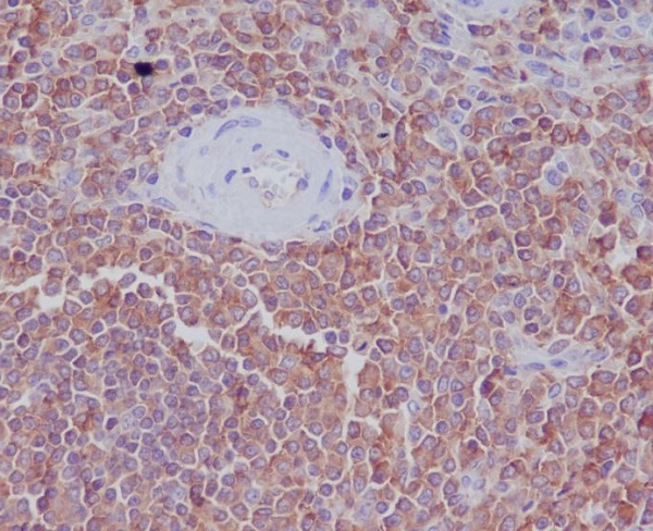 2 - Anti-Radixin Rabbit Monoclonal Antibody ABO13896