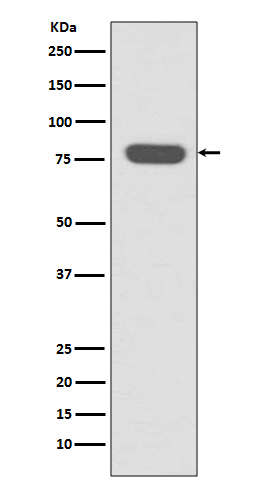 1 - Anti-Radixin Rabbit Monoclonal Antibody ABO13896