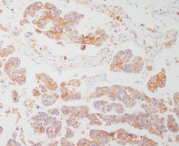 2 - Anti-HLA-DRA/Hla Dr Rabbit Monoclonal Antibody ABO13897