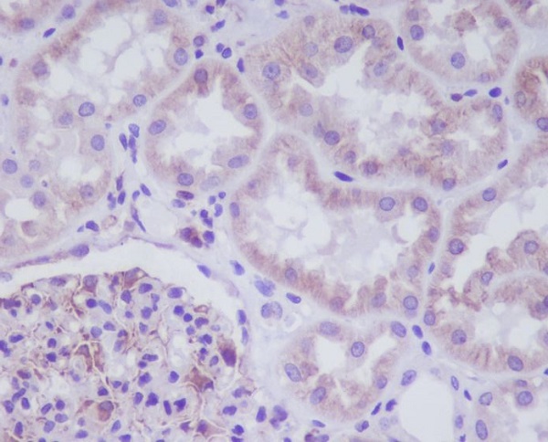 2 - Anti-ADIPOR1 Rabbit Monoclonal Antibody ABO13898