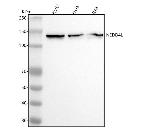 1 - Anti-NEDD4-2 NEDD4L Rabbit Monoclonal Antibody ABO13899