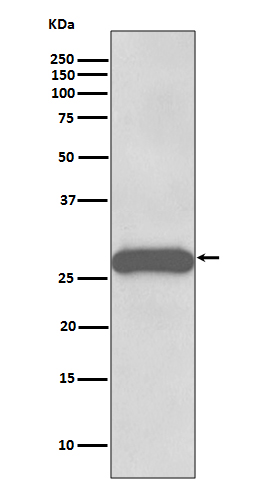1 - Anti-PPP1R1A Rabbit Monoclonal Antibody ABO13901