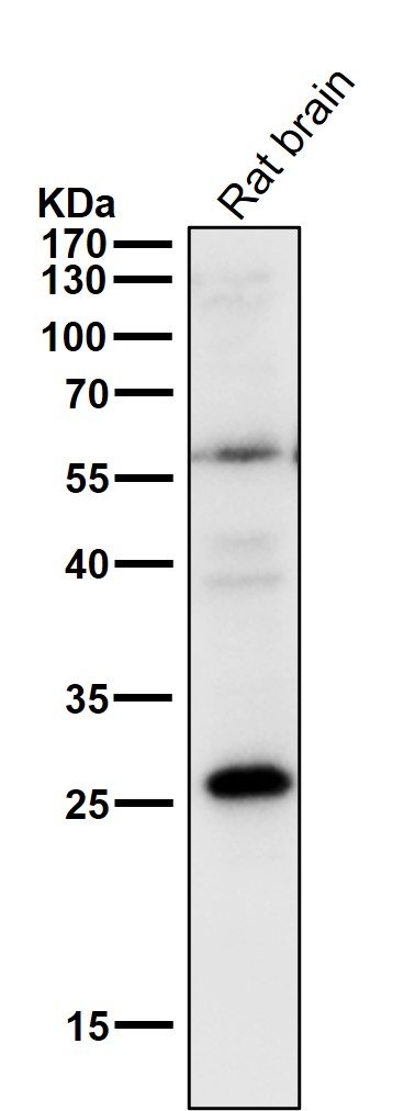 1 - Anti-PPP1R1A Rabbit Monoclonal Antibody ABO13901