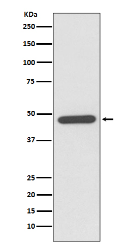 1 - Anti-NeuroD1 Rabbit Monoclonal Antibody ABO13905