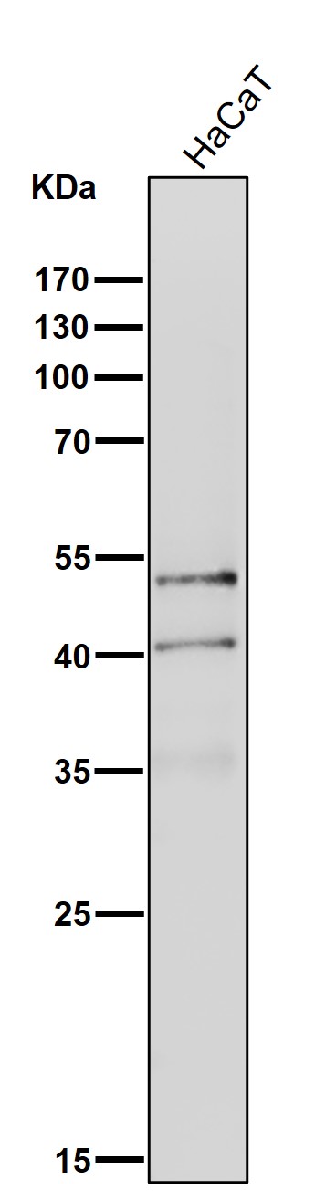 1 - Anti-NeuroD1 Rabbit Monoclonal Antibody ABO13905