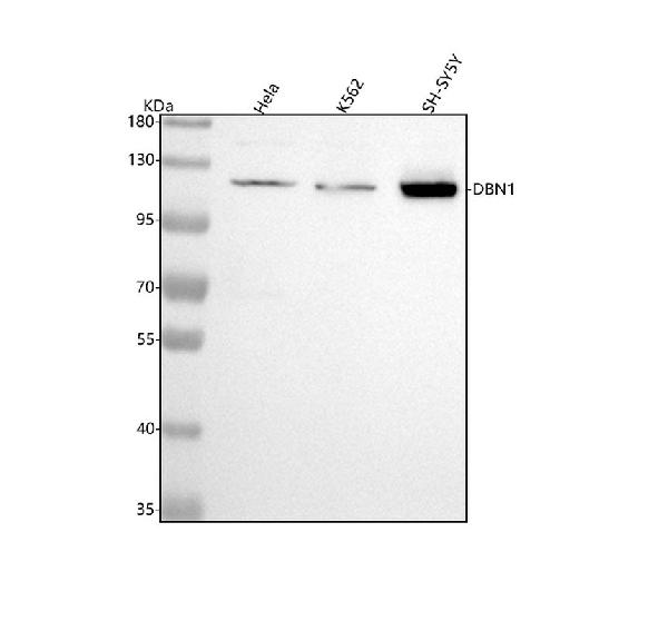 1 - Anti-Drebrin DBN1 Rabbit Monoclonal Antibody ABO13906