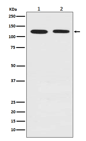 1 - Anti-Drebrin DBN1 Rabbit Monoclonal Antibody ABO13906