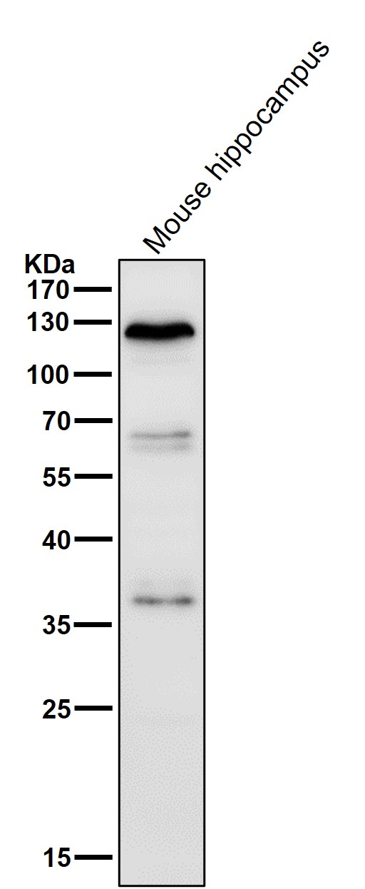 1 - Anti-Drebrin DBN1 Rabbit Monoclonal Antibody ABO13906