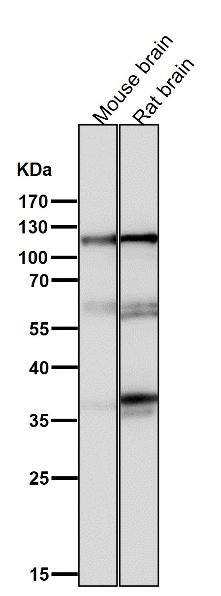 1 - Anti-Drebrin DBN1 Rabbit Monoclonal Antibody ABO13906