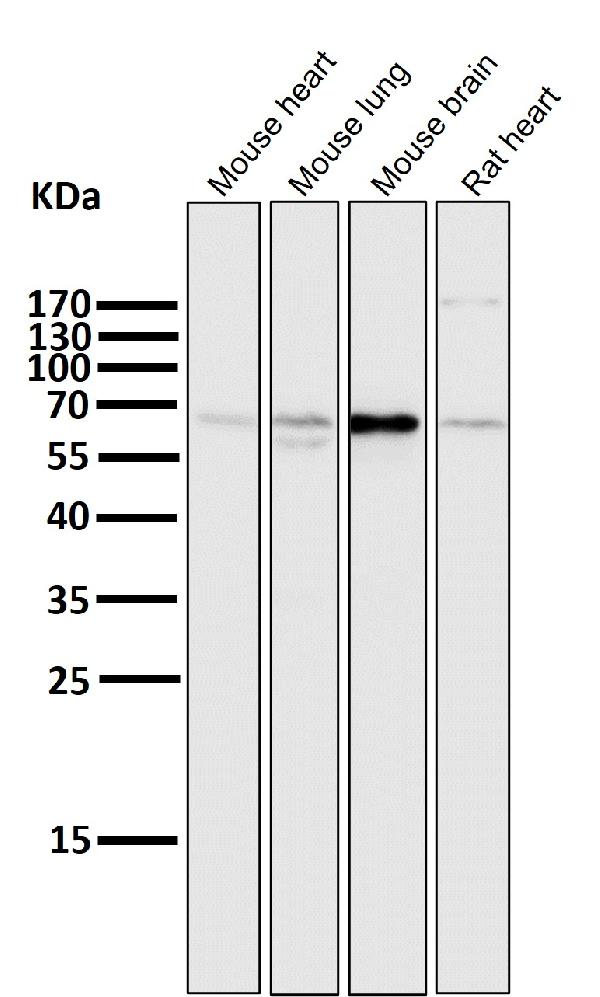 1 - Anti-Atg16L1/Atg16 Rabbit Monoclonal Antibody ABO13907