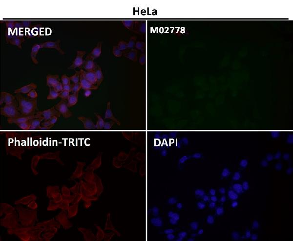 1 - Anti-Lamin B1 LMNB1 Rabbit Monoclonal Antibody ABO13908