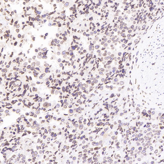2 - Anti-Lamin B1 LMNB1 Rabbit Monoclonal Antibody ABO13908